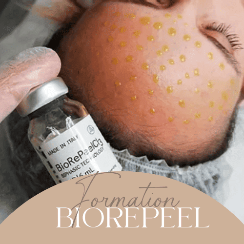 Formation BioRePeel. ormez-vous au BioRePeel, un peeling médical qui régénère la peau en profondeur, idéal pour traiter les signes de l'âge et les imperfections cutanées.